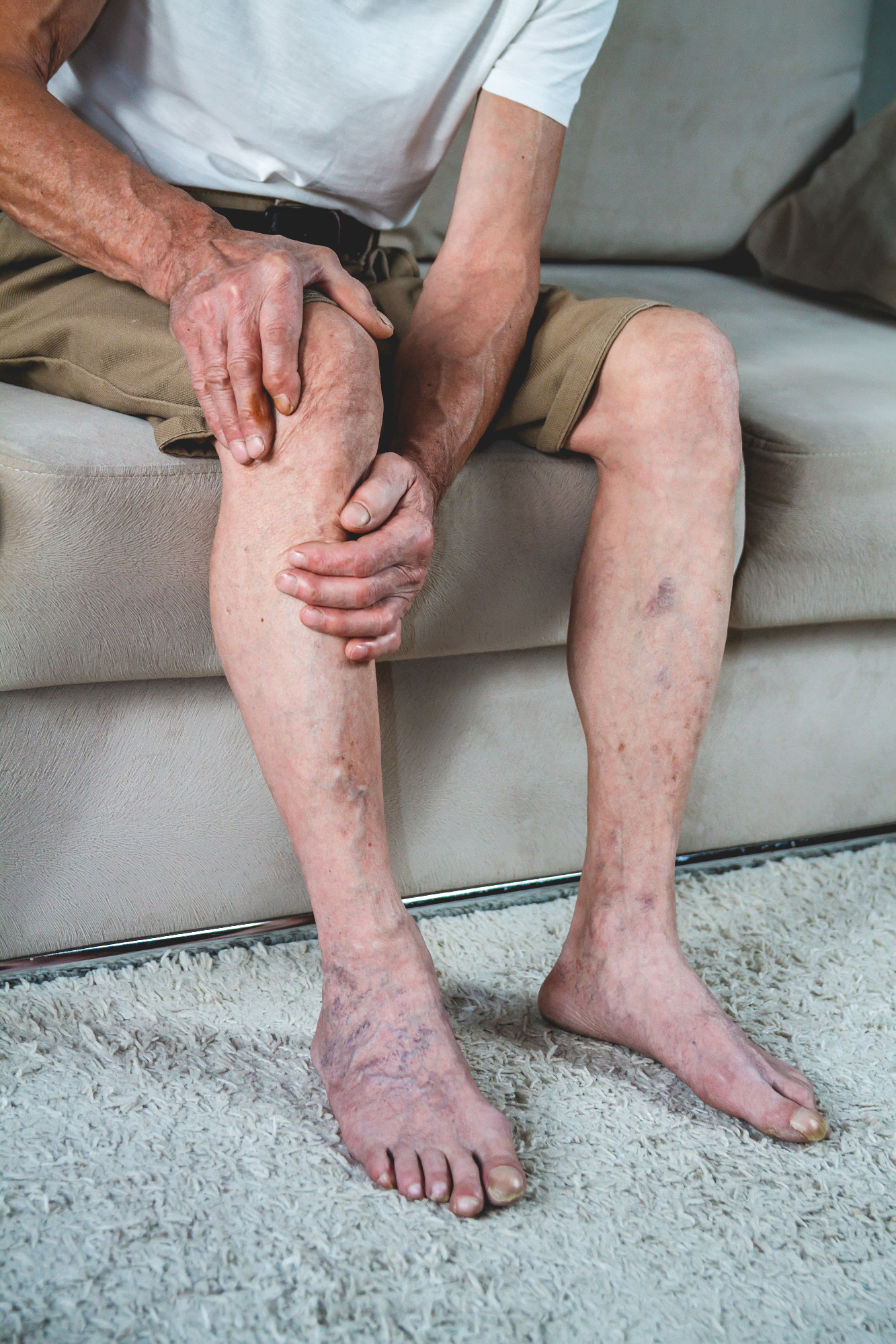 Revmatoidni artritis je nekaj, kar lahko doleti marsikoga
